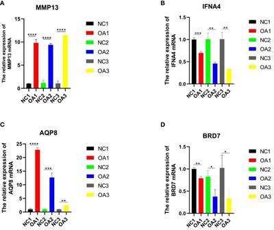 Machine learning identifies ferroptosis-related genes as potential diagnostic biomarkers for osteoarthritis